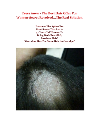 Tress Anew - The Best Hair Offer For Women-Secret Revolved