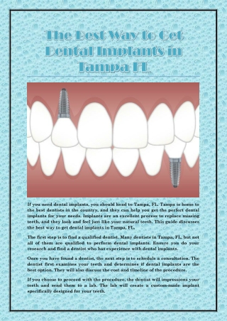 The Best Way to Get Dental Implants in Tampa FL