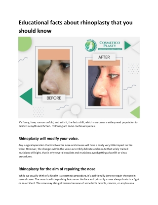 Educational facts about rhinoplasty that you should know