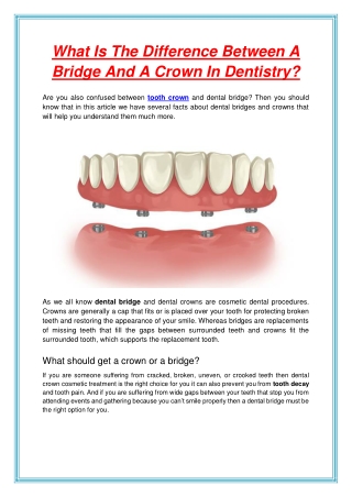 What Is The Difference Between A Bridge And A Crown In Dentistry