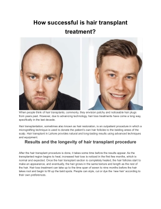 How successful is hair transplant treatment