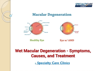 Wet Macular Degeneration - Symptoms, Causes, and Treatment