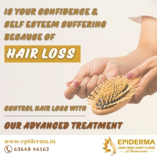 Advanced Hairloss Treatment | Best Hairloss in Jayanagar | Epiderma Clinic