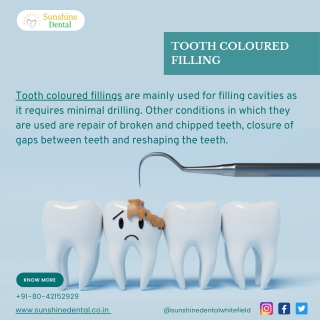 Tooth Coloured Filling | Best Dental Treatment in Whitefield | Sunshine Dental