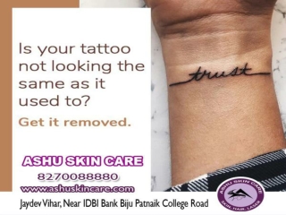 One of the best  cosmetology clinic for laser tattoo removal in bhubaneswar, odisha.