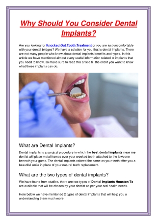 Why Should You Consider Dental Implants