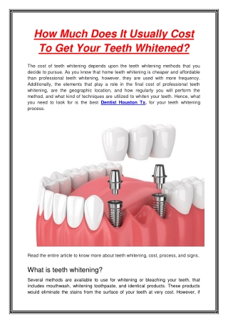 How Much Does It Usually Cost To Get Your Teeth Whitened