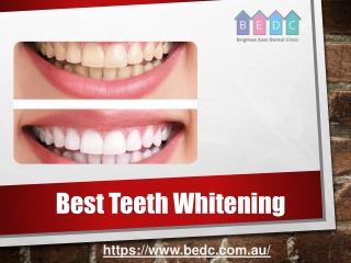 Best Teeth Whitening - (03-95788500) - BEDC