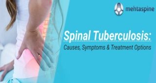 Symptoms and Diagnosis of Spinal Tuberculosis of Thoracic Spine