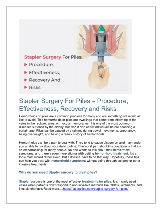 Stapler Surgery For Piles