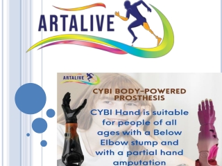 motorica-prosthetics-upper-limb-cybi-hand - Artalive