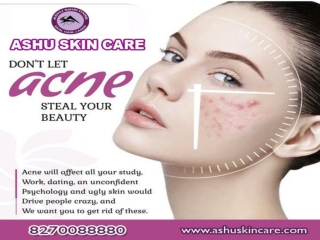 One of the best  cosmetic clinic for skin care treatment in bhubaneswar, odisha.