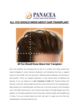 ALL YOU SHOULD KNOW ABOUT HAIR TRANSPLANT