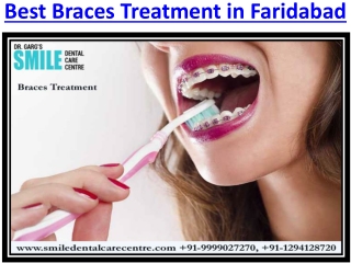 Dental Clinic to Get Best Invisible Aligner Treatment in Faridabad