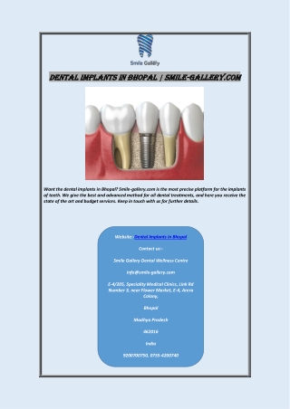 Dental Implants In Bhopal | Smile-gallery.com