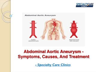 Abdominal Aortic Aneurysm - Symptoms, Causes, And Treatment