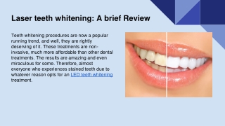 Laser teeth whitening A brief Review