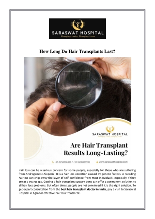 How Long Do Hair Transplants Last?