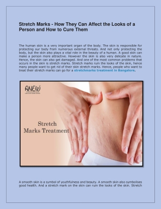 Stretch Marks - How They Can Affect the Looks of a Person and How t