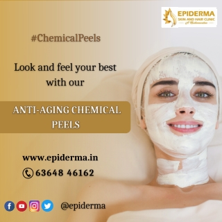 Anti aging chemical peels - Best Dermatologist​ in Jayanagar - Epiderma Clinic