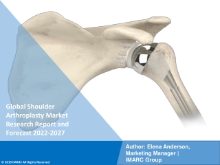 Shoulder Arthroplasty Market PDF, Size, Share, Trends, Industry Scope 2022-2027