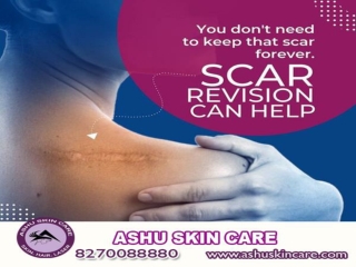 No 1 cosmetic clinic in bhubaneswar, odisha.