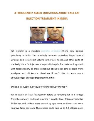 All You Need to Know About Face Fat Injection Treatment in India