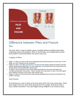 Difference between Piles and Fissure