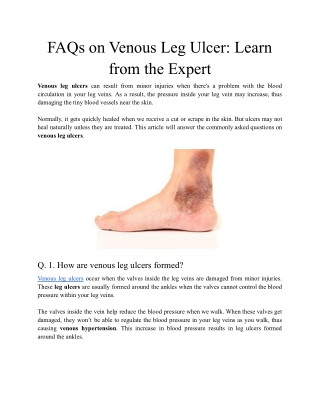 FAQs on Venous Leg Ulcer: Learn from the Expert