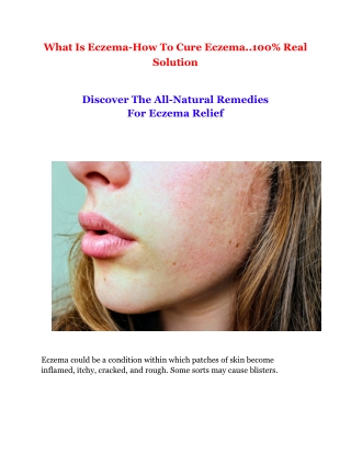What Is Eczema-How To Cure Eczema