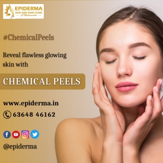 Chemical peels Treatment | Best Skin Clinic in Jayanagar | Epiderma Clinic