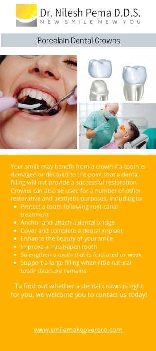 Best Porcelain Dental Crowns