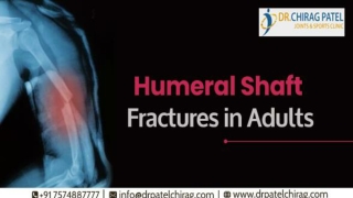 Humeral Shaft Fractures in Adults |Bone specialist in Mumbai