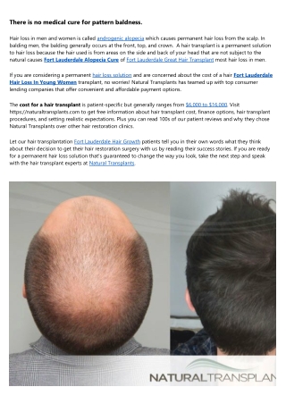 Fort Lauderdale  Hair Loss Thinning 2022
