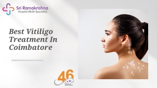 Best Vitiligo Treatment - Sri Ramakrishna Hospital