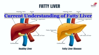 Current Understanding of Fatty Liver