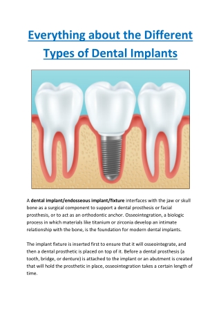 Everything about the Different Types of Dental Implants