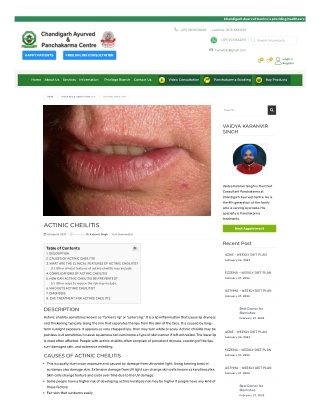 www-chandigarhayurvedcentre-com-blog-actinic-cheilitis