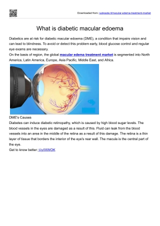 macular-edema-treatment-market