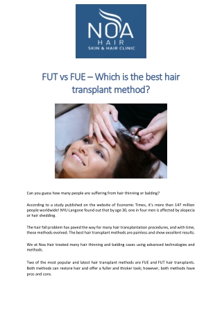 FUT vs FUE – Which is the best hair transplant method