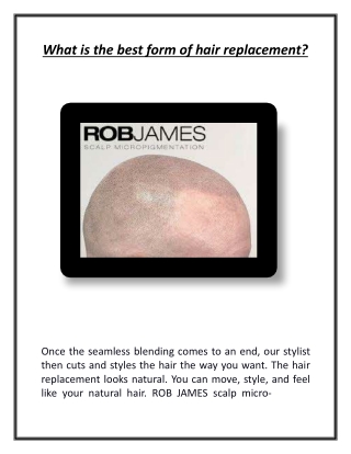 What is the best form of hair replacement