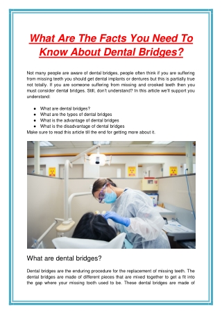 What Are The Facts You Need To Know About Dental Bridges