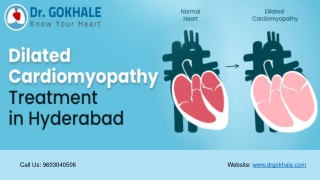 Dilated Cardiomyopathy Treatment in Hyderabad | Dr Gokhale