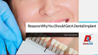 Reasons Why You Should Get A Dental Implant