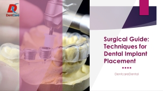 Surgical Guide Techniques for Dental Implant Placement