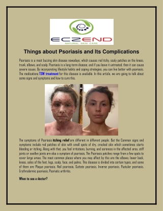 Things about Psoriasis and Its Complications