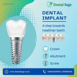 Dental Implants | Best Dental Clinic in Yelahanka | Dental Sage