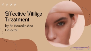 Permanent Treatment for Vitiligo in Coimbatore