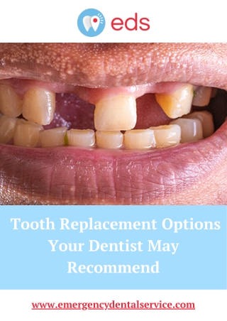 Tooth Replacement Options Your Dentist May Recommend | Emergency Dental Service