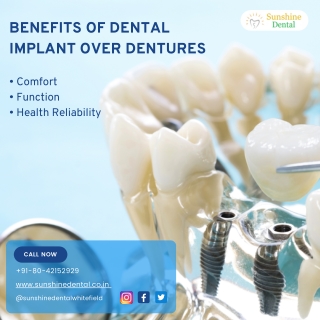Benefits of Dental Implants over Dentures | Best Orthodontist In Whitefield